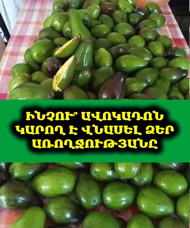 🤔 Կարո՞ղ է ձեր սիրելի 🥑ավոկադոն վնասել. 5 անսպասելի ռիսկ, որոնց մասին պետք է իմանաք։