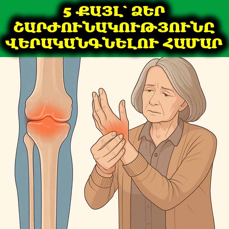 Հոդերի թշնամիները. ով է գողանում ձեր շարժունակությունը և ինչպես վերադարձնել կորցրածը🦵💥