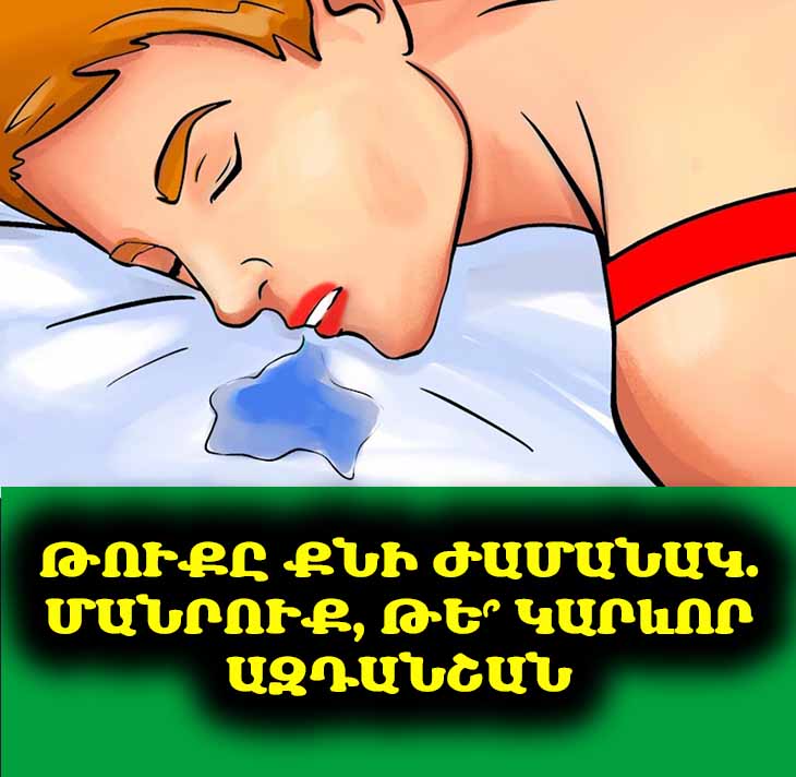 Գիշերային 💧 թքարտադրության 6️⃣ հնարավոր բժշկական պատճառները 😴