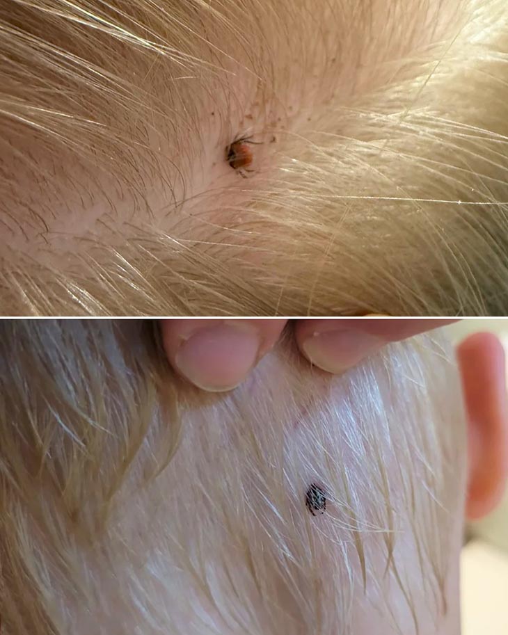 Հենց նոր մի բան հայտնաբերեցի որդուս մազերում. ի՞նչ կարող է լինել։ 🤔