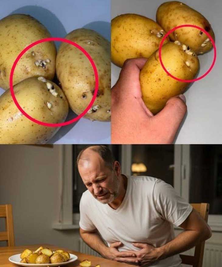 Բողբոջած Կարտոֆիլ. Ձեր Խոհանոցի Լուռ Թշնամին, Որը Կարող է Վնասել Ձեր Առողջությանը, Զգույշ Եղեք ⚠️