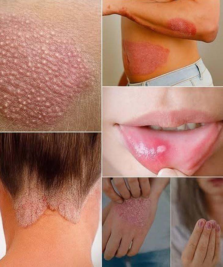 Մաշկի Ազդանշանները. Նշաններ, Որոնք Դուք Պետք է Իմանաք Ձեր Առողջության Մասին 🩺✨