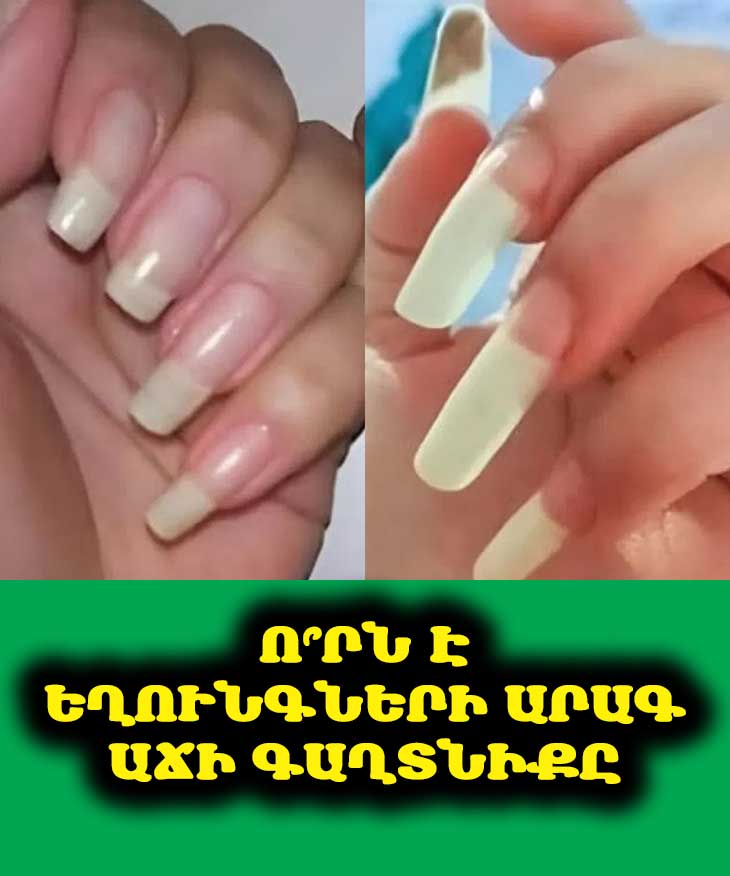 💅 Եղունգների արագ աճը կարո՞ղ է հիվանդության նշան լինել. 7 անսպասելի պատճառ