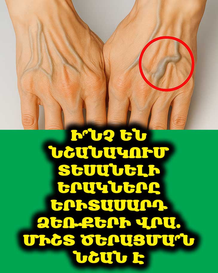 Ի՞նչ են Նշանակում Տեսանելի Երակները Երիտասարդ Ձեռքերի Վրա. Միշտ Ծերացմա՞ն Նշան Է 😳💪🧬
