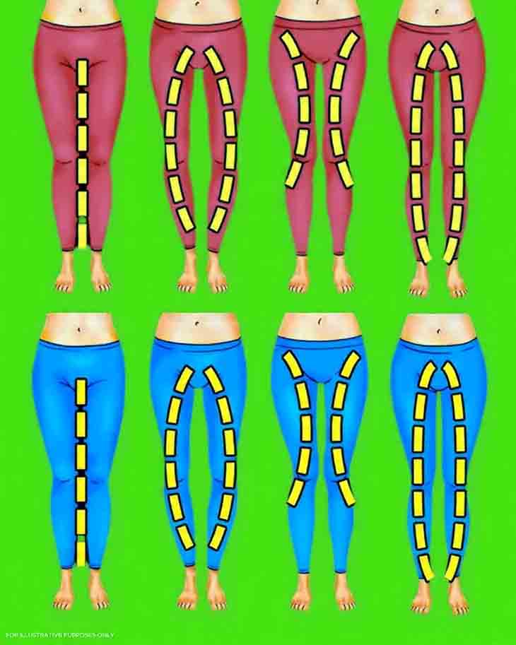 ՁԵՐ ՈՏՔԵՐԻ ՁԵՎԸ ԿԱՐՈ՞Ղ Է ԲԱՑԱՀԱՅՏԵԼ ՁԵՐ ԲՆԱՎՈՐՈՒԹՅՈՒՆԸ 🦵