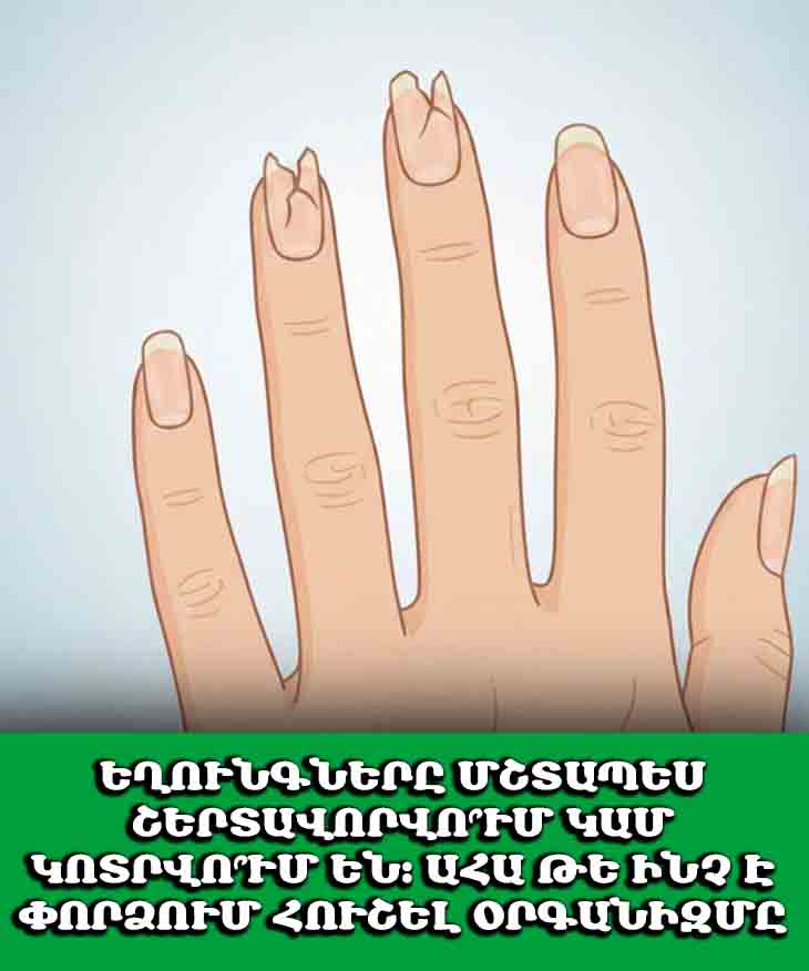 💅 ԵՂՈՒՆԳՆԵՐԸ ՄՇՏԱՊԵՍ ՇԵՐՏԱՎՈՐՎՈ՞ՒՄ ԿԱՄ ԿՈՏՐՎՈ՞ՒՄ ԵՆ։ ԱՀԱ ԹԵ ԻՆՉ Է ՓՈՐՁՈՒՄ ՀՈՒՇԵԼ ՕՐԳԱՆԻԶՄԸ 💅