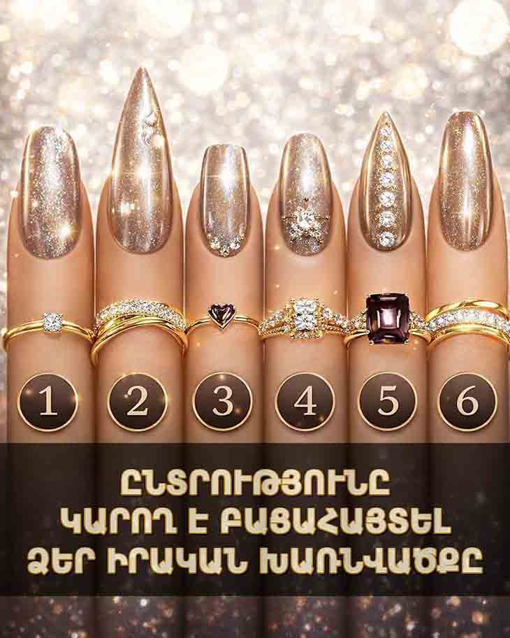 💅 Ի՞ՆՉ Է ՊԱՏՄՈՒՄ ՁԵՐ ԲՆԱՎՈՐՈՒԹՅԱՆ ՄԱՍԻՆ ՄԱՏՆԱՀԱՐԴԱՐՄԱՆ ՍԻՐԵԼԻ ՈՃԸ 💅