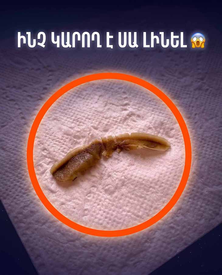 😱 ԳՏԱ ՍԱ ԸՆԿԵՐՈՒՀՈՒՍ ԼՈԳԱՍԵՆՅԱԿՈՒՄ. ԱՅՆ ՇԵՐՏԱՎՈՐ Է ՈՒ ՀԵՇՏՈՒԹՅԱՄԲ ԾԱԼՎՈՒՄ Է, ՇՈՒՐՋԲՈԼՈՐԸ ՆՄԱՆ ՈՉԻՆՉ ՉԿԱ, ԵՎ ԵՍ ՄԵԿ ԺԱՄ ՇԱՐՈՒՆԱԿ ՆԱՅՈՒՄ ԵՄ ԴՐԱՆ՝ ԳԱՂԱՓԱՐ ԱՆԳԱՄ ՉՈՒՆԵՆԱԼՈՎ, ԹԵ ԻՆՉ ԿԱՐՈՂ Է ԼԻՆԵԼ 😱