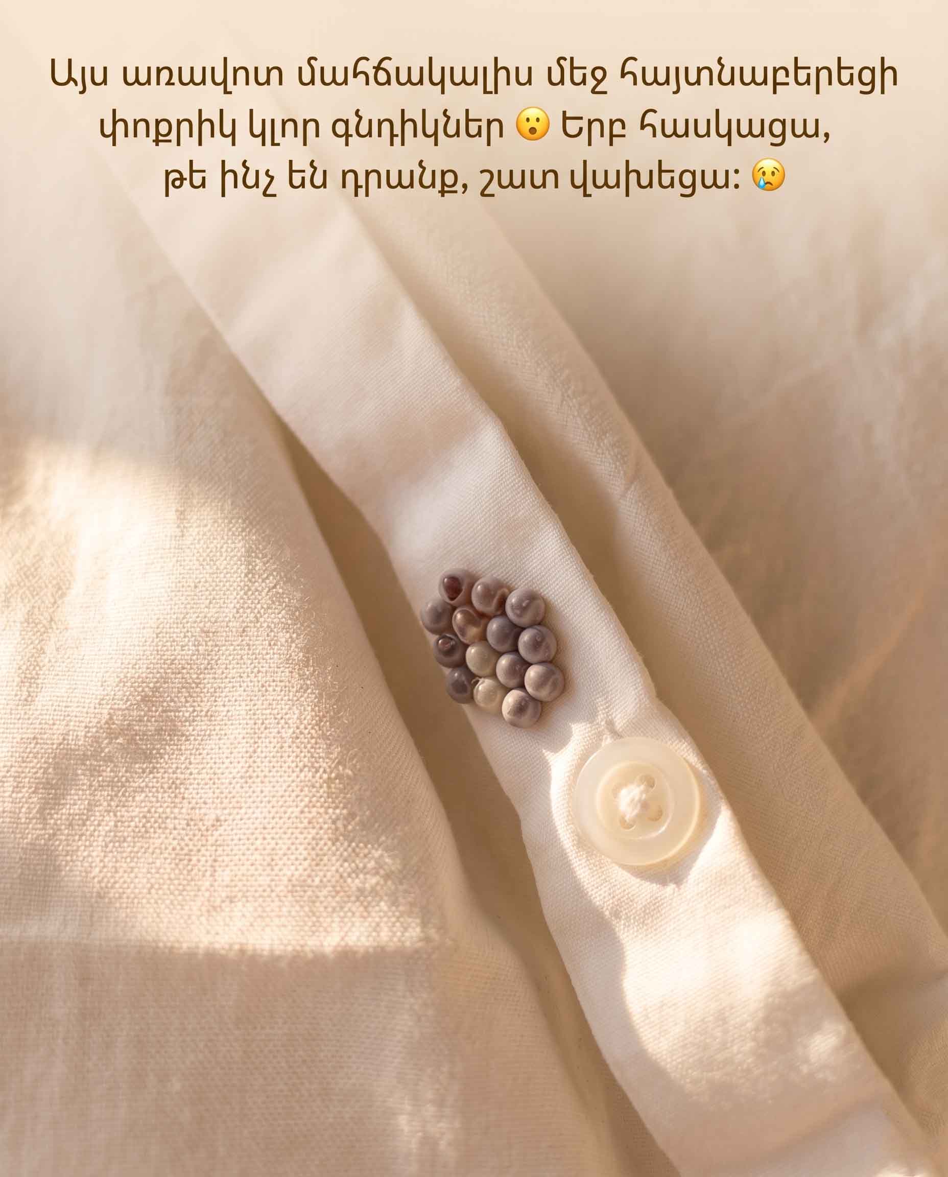 Այդ փոքրիկ գնդիկները ձեր մահճակալո՞ւմ: Ահա թե ինչ են դրանք իրականում